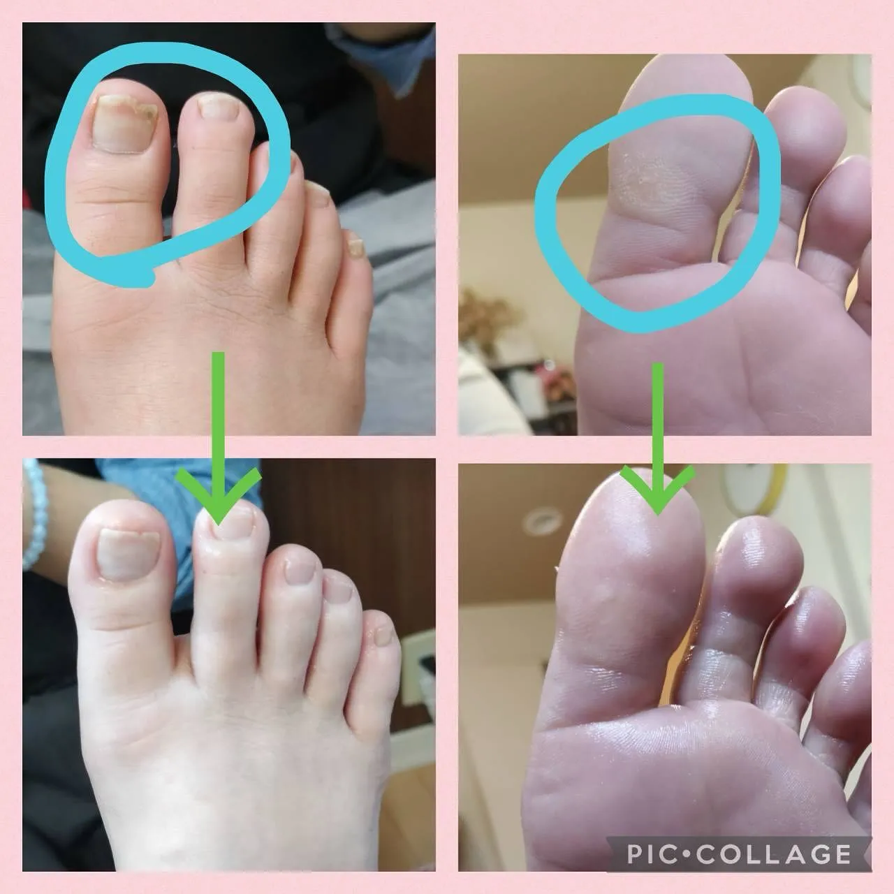 自分メンテナンス✨フットケアをしてきました👣💆♀️💖。