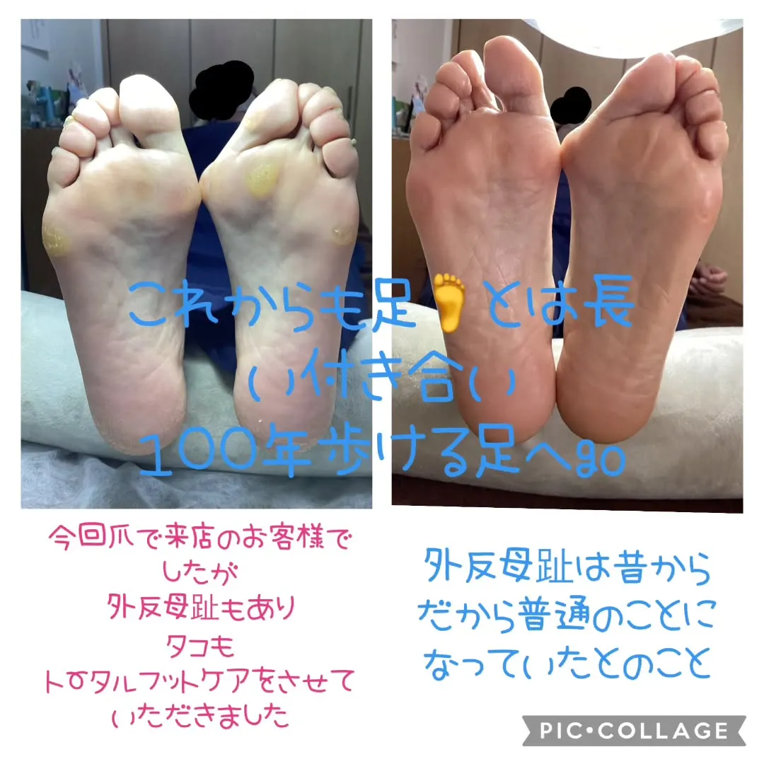 爪のお悩みでご来店のお客様