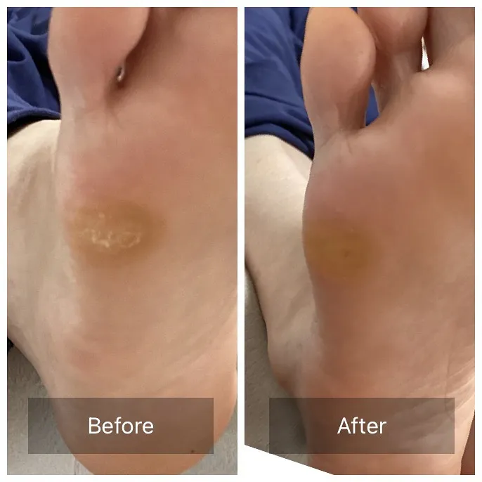 🌿 すべての方のために、足元の快適さを提供します！