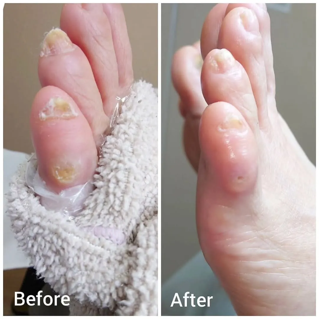 魚の目とたこのちがいわかりますか？