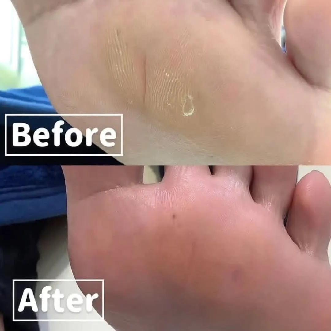 魚の目とたこのちがいわかりますか？