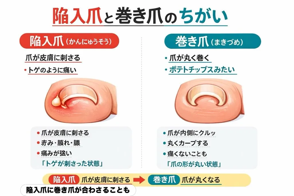 💡足元の健康は、全身の健康の鍵🔑です！あなたの大切な足を守る...