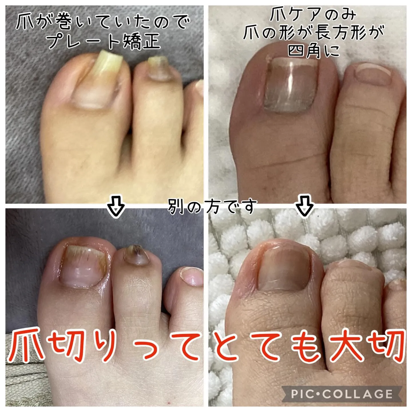 💡足元の健康は、全身の健康の鍵🔑です！あなたの大切な足を守る...